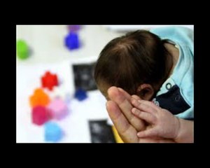 Zika virus e microcefalia: uno studio li collega