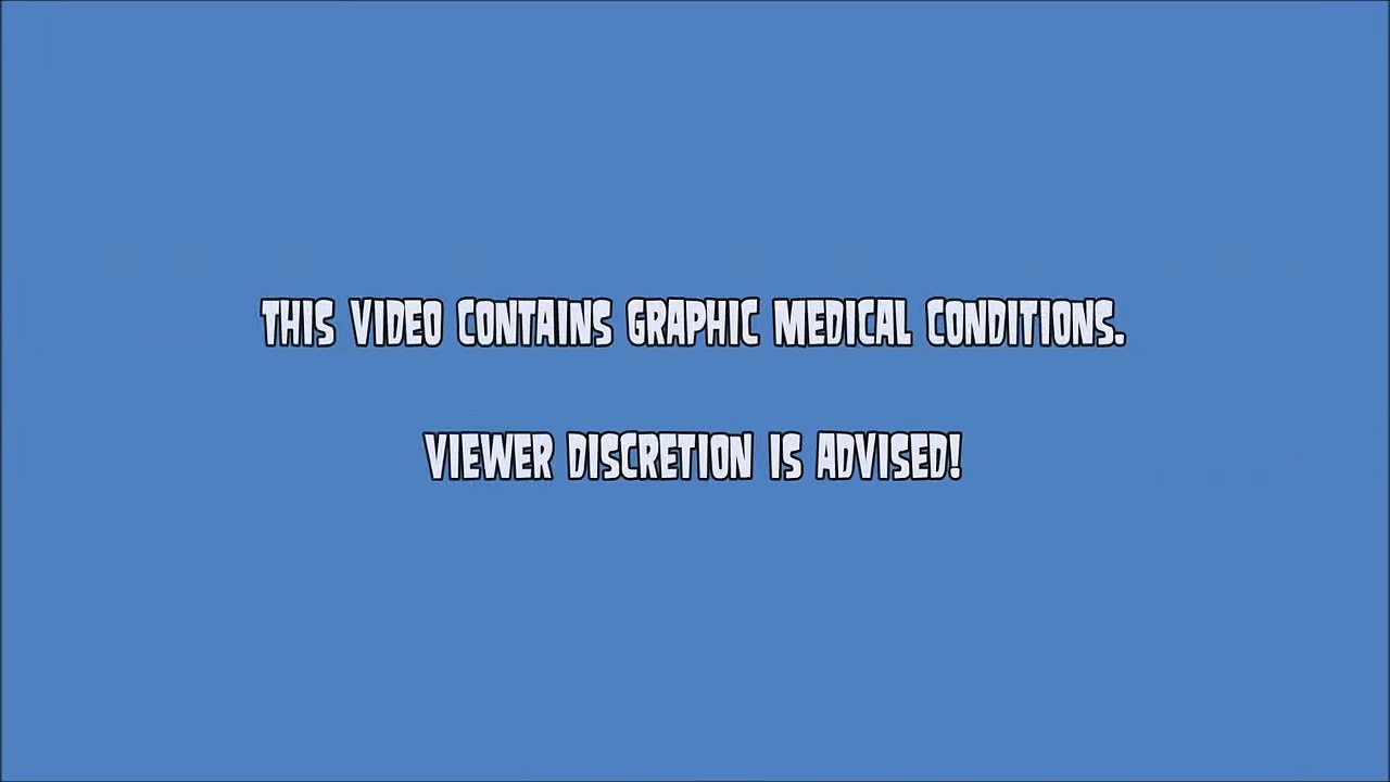 Sebaceous Cyst, Staph Infection Trypophobia and More!