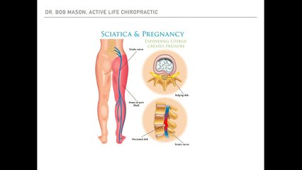 The Best Stretches for back pain during pregnancy