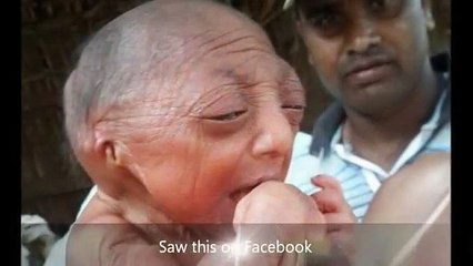 Indian Woman Gave Birth to Miracle Baby Looks 105 Years Old