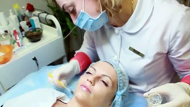 Химический пилинг лица. Beauty Ksu