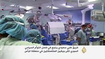 فريق طبي سعودي ينجح بفصل توائم ملتصقين في منطقة الرأس بعملية استمرت 14 ساعة