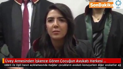 Kayseride Üvey Annesinden İşkence Gören Çocuğun Avukatı Herkesi Ağlattı