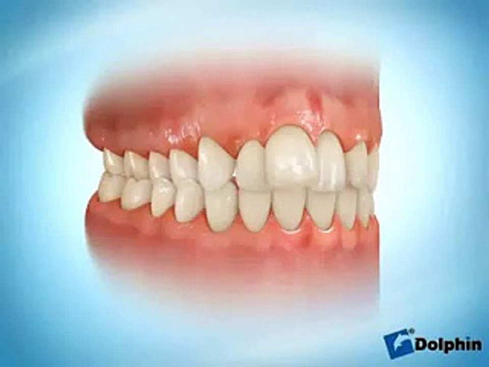 Funny whatsapp video 2015/2016 very funny - Dailymotion