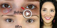 Get Rid Of Dark Circles Naturally Home Remedies For Girls