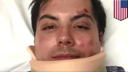 アフリカ系少年ら男性に暴行