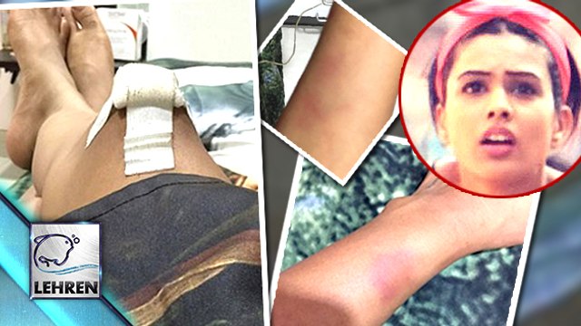 'Jamai Raja' Actress Roshini Aka Nia Sharma INJURED | Zee TV