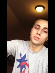 Old Spice Deodorant Chemical Burn