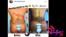 Sky From Black Ink Crew Posted Pictures Of Her New Butt On Instragram