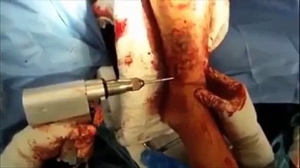 Change the way you think...save your life it's simple!!!