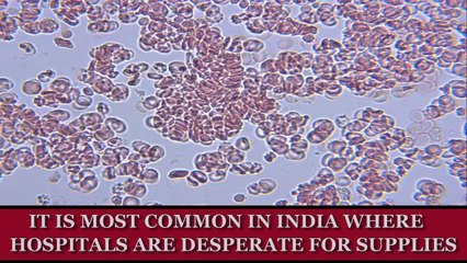 The Cost Of Your Body Parts On The Black Market