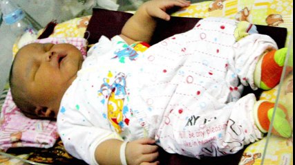 TOP 10 STRANGEST BIRTHS IN THE WORLD