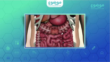 سرطان القولون اسبابه واعراضه