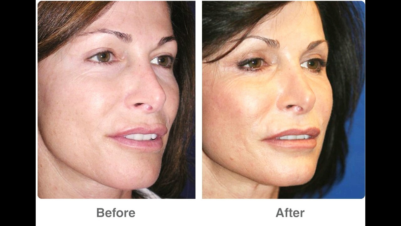 Home facial treatment | best facial product for skin care