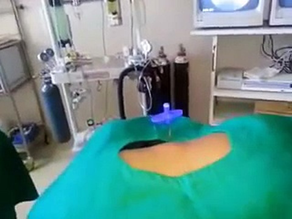 Cervical Epidural Injection