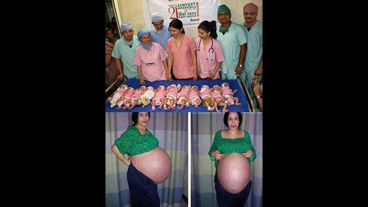 Un femme enceinte accouche de 11 bébés - Vidéo Dailymotion