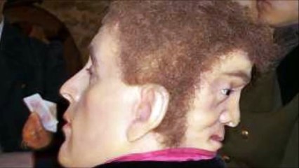 Edward Mordake - The man with two faces