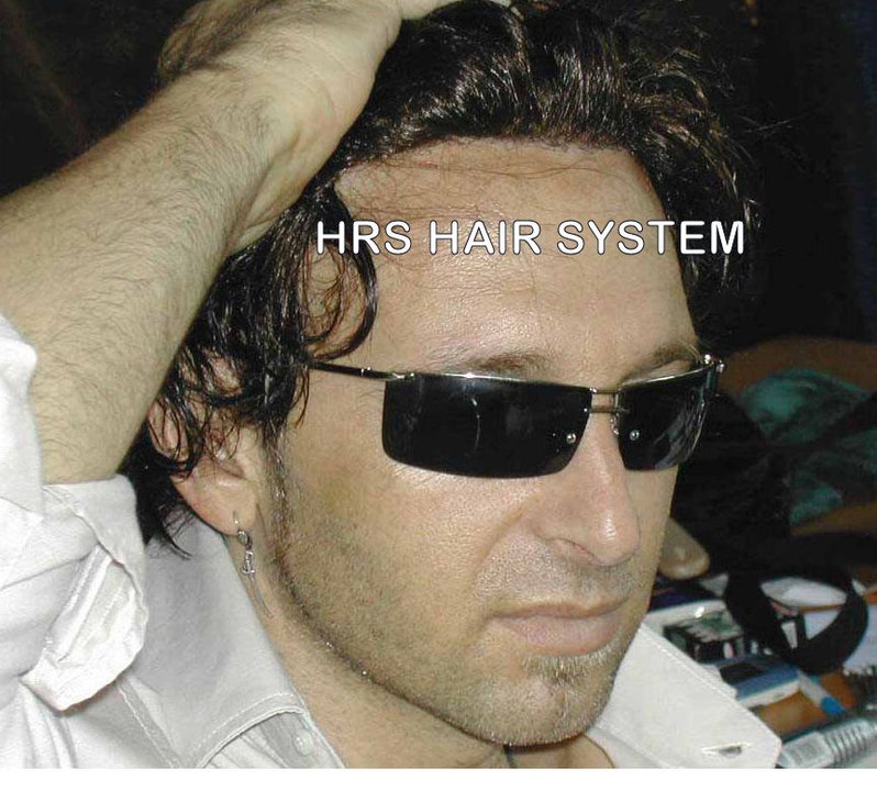 protesi capelli