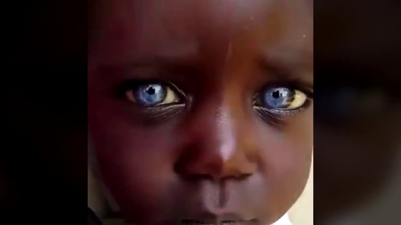 Rare - une petite fille noire avec les yeux bleus !