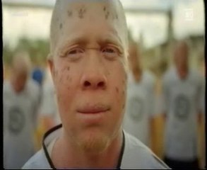 Albino United: Melanocitos y color de la piel