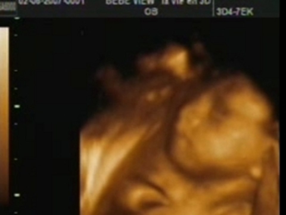 junior video 11