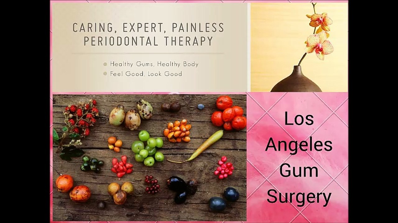 Los Angeles Dental Implant