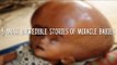 5 Most Shocking & Yet Amazing Stories of Miracle Babies!