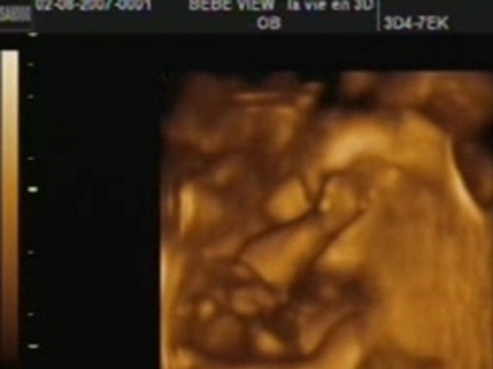 junior video 20