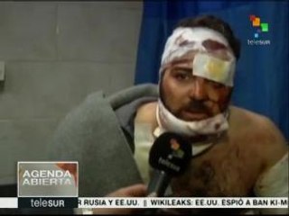 Siria aceptaría cese al fuego pactado por Rusia y EE.UU.