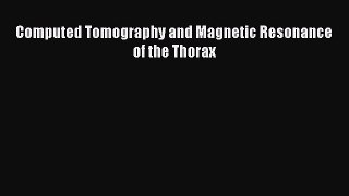 Download Computed Tomography and Magnetic Resonance of the Thorax Read Full Ebook