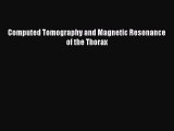 Download Computed Tomography and Magnetic Resonance of the Thorax Read Full Ebook