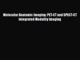 Download Molecular Anatomic Imaging: PET-CT and SPECT-CT Integrated Modality Imaging Free Online