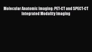 Download Molecular Anatomic Imaging: PET-CT and SPECT-CT Integrated Modality Imaging Free Online