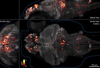 Inside The Zebrafish Brain