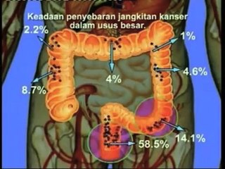 0821-6541-0786 (Tsel), Agen Fiforlif di Medan