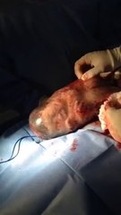 Bébé né dans son sac amniotique