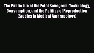[PDF] The Public Life of the Fetal Sonogram: Technology Consumption and the Politics of Reproduction