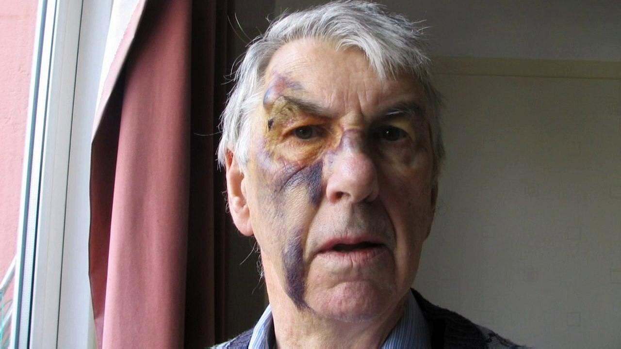 Pensioner beaten in his bed thinks attackers wo...