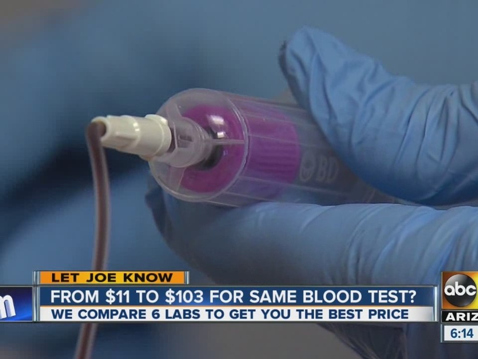 From $11 to $103 for same blood test?