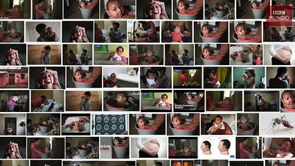 Zika: ¿Cómo es la vida del bebé con microcefalia de esta famosa foto?