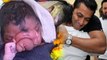 Salman's Being Human Donates 40 LAKHS For 2 Head Baby Surgery