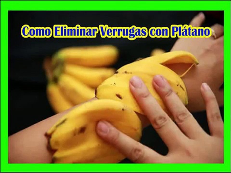 remedios caseros para eliminar verrugas, con cáscara de plátano: