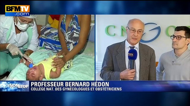 Zika: les échographies permettent de juger de la gravité