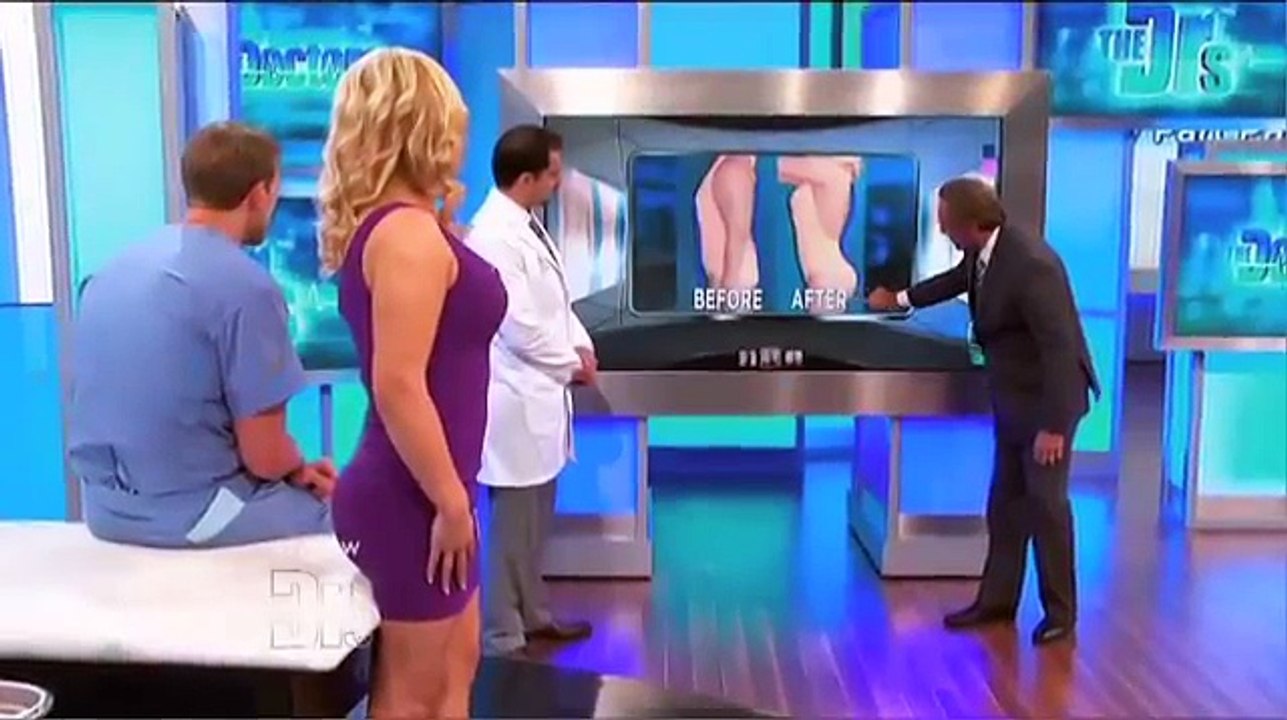 Brazilian Butt Lift Surgery and Results on The Doctors TV Show with Dr. Ghavami