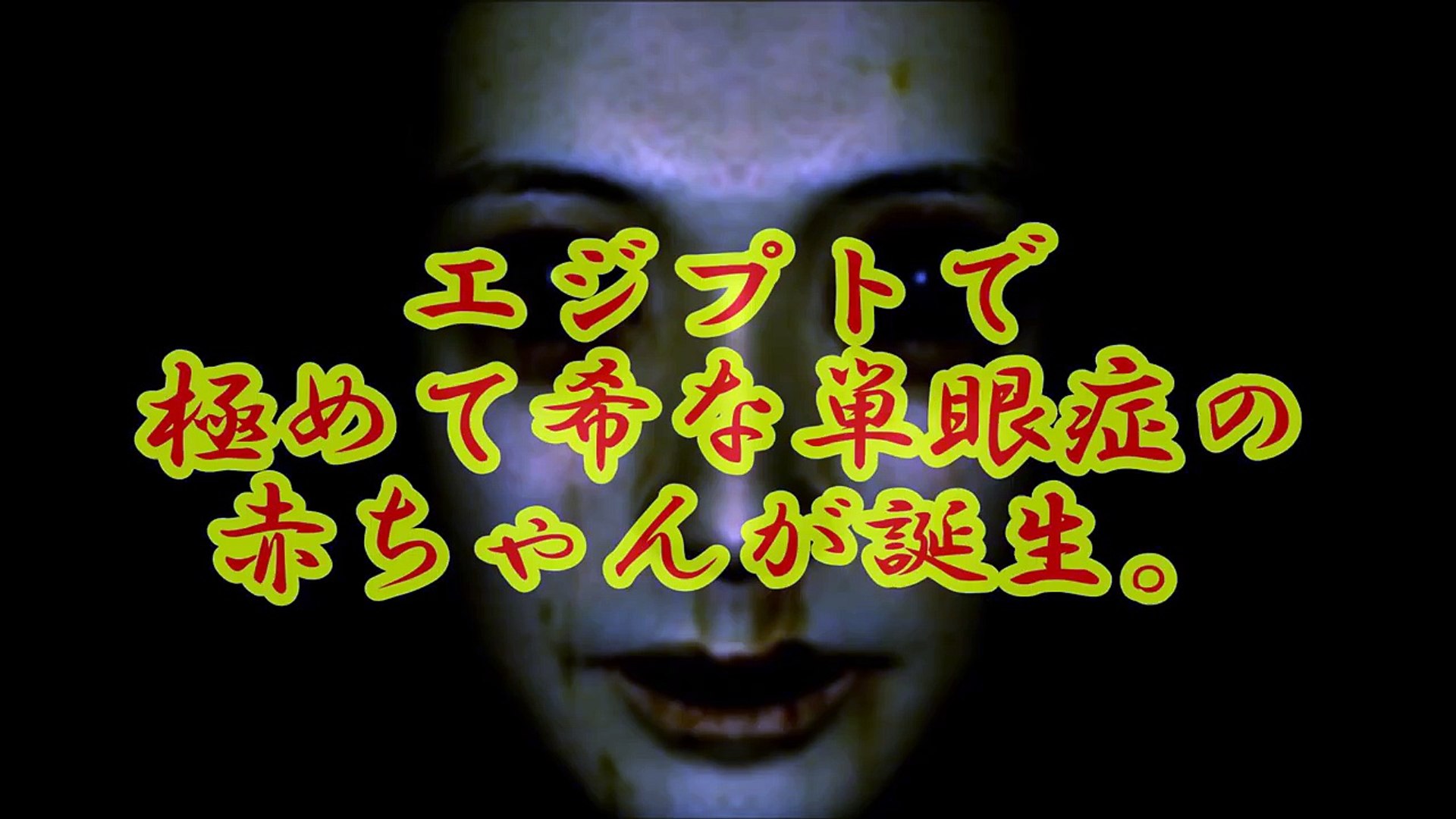 衝撃注意 極めて希な単眼症の奇形児の赤ちゃんが出産したとネットが騒然 閲覧注意 Dailymotion Video