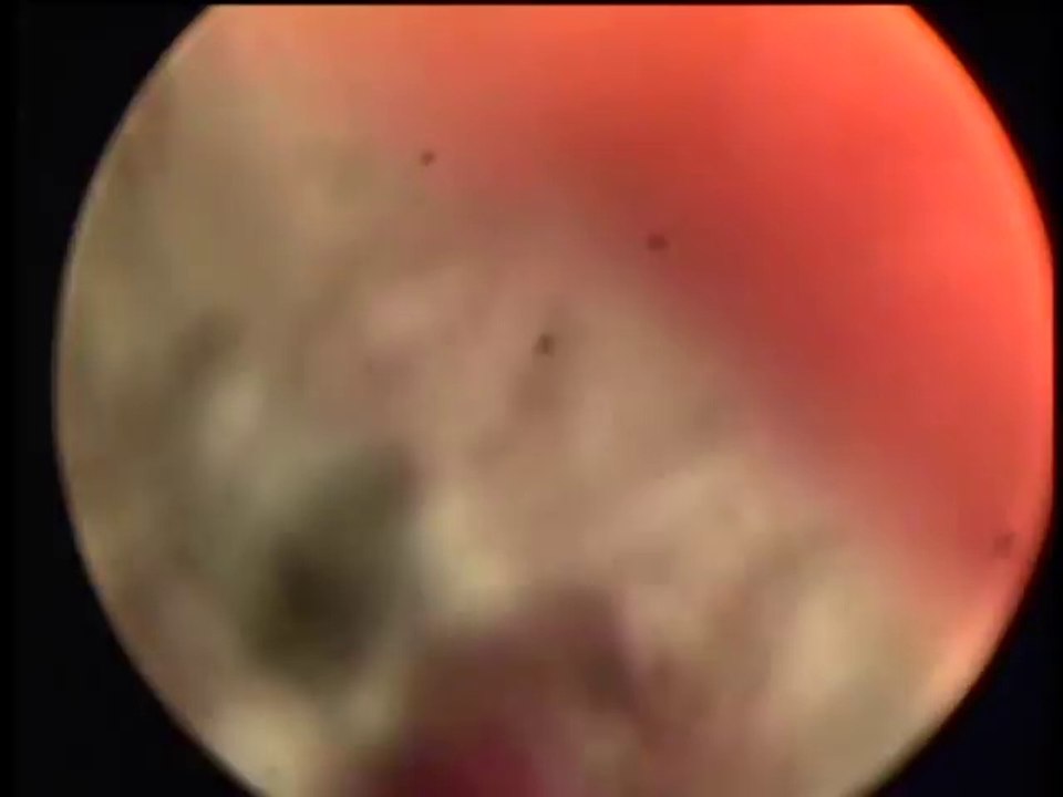 Il souffre d'un terrible mal d'oreille!