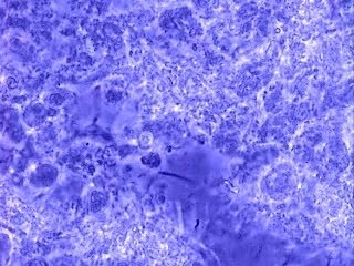 Recherche amibes orales