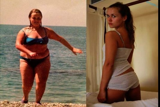 До и после похудения