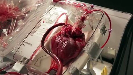 Fascinating video of a donors heart being kept beating.