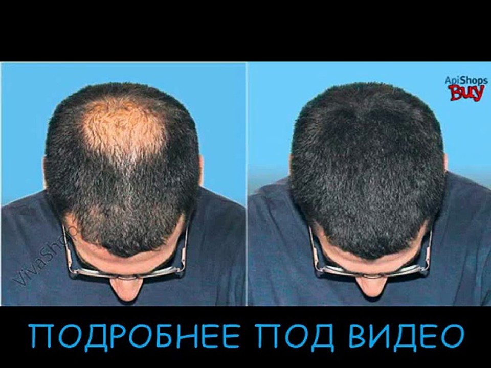 загуститель для волос fully hair